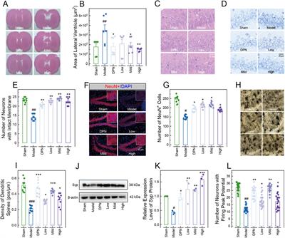 Combined administration of catalpol, puerarin, gastrodin, and borneol modulates the Tlr4/Myd88/NF-κB signaling pathway and alleviates microglia inflammation in Alzheimer’s disease